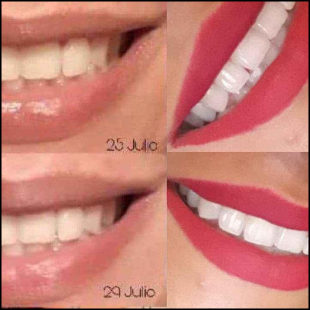 Whitening Toothpaste - Picture 3 of 3